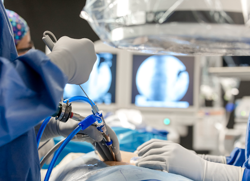 Cervical disc herniation surgery: why choose the posterior endoscopic approach?