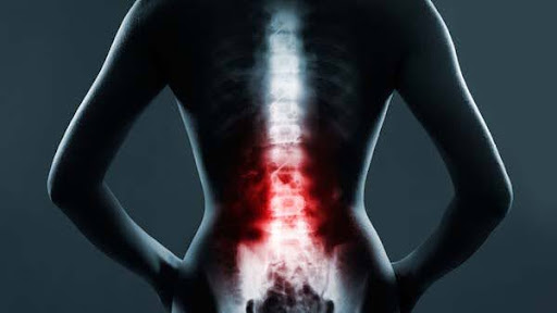 The rare but possible risks of endoscopic spine surgery